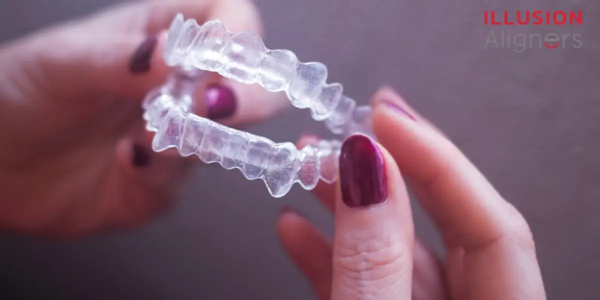 Difference between Aligners vs braces - Illusion Aligners