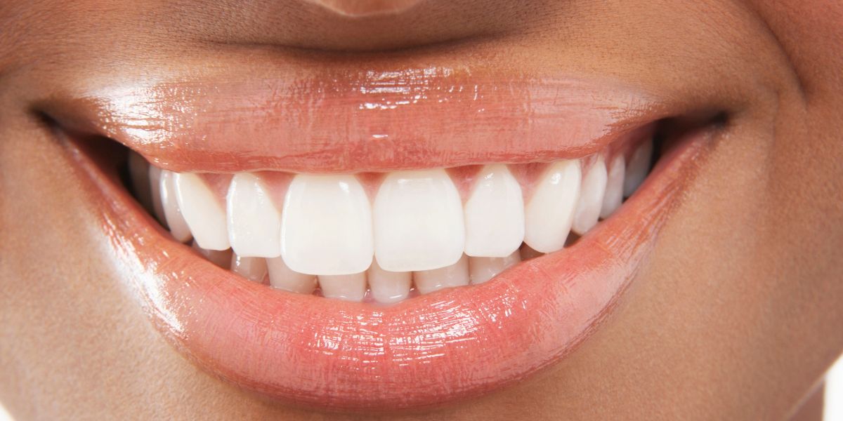 Malocclusion Symptoms, Signs and Cure - Illusion Aligners