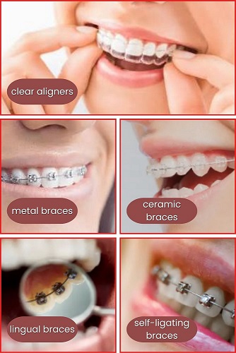 infographic