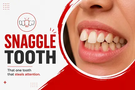 snaggle tooth