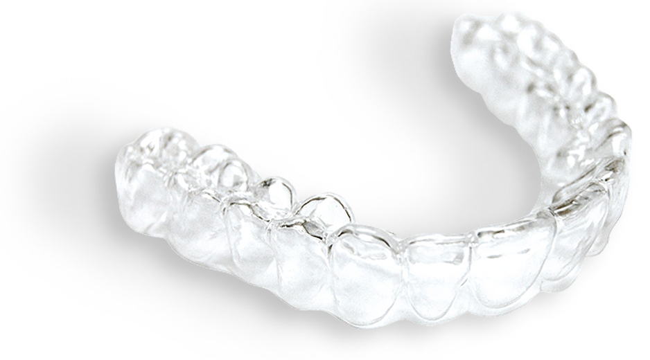 Benefits of clear aligners