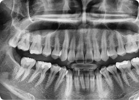 X-ray