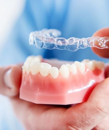 Illusion Aligners for Patients - It starts with your smile